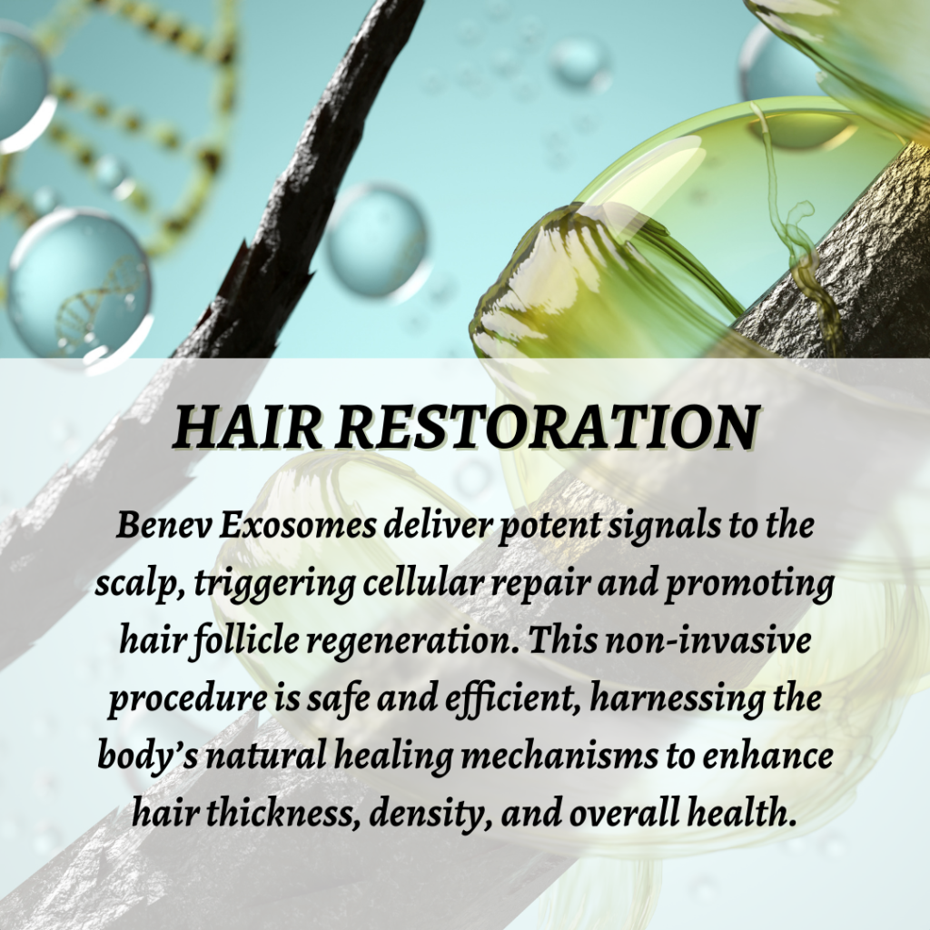 Hair restoration treatment with exosomes, promoting natural hair growth.