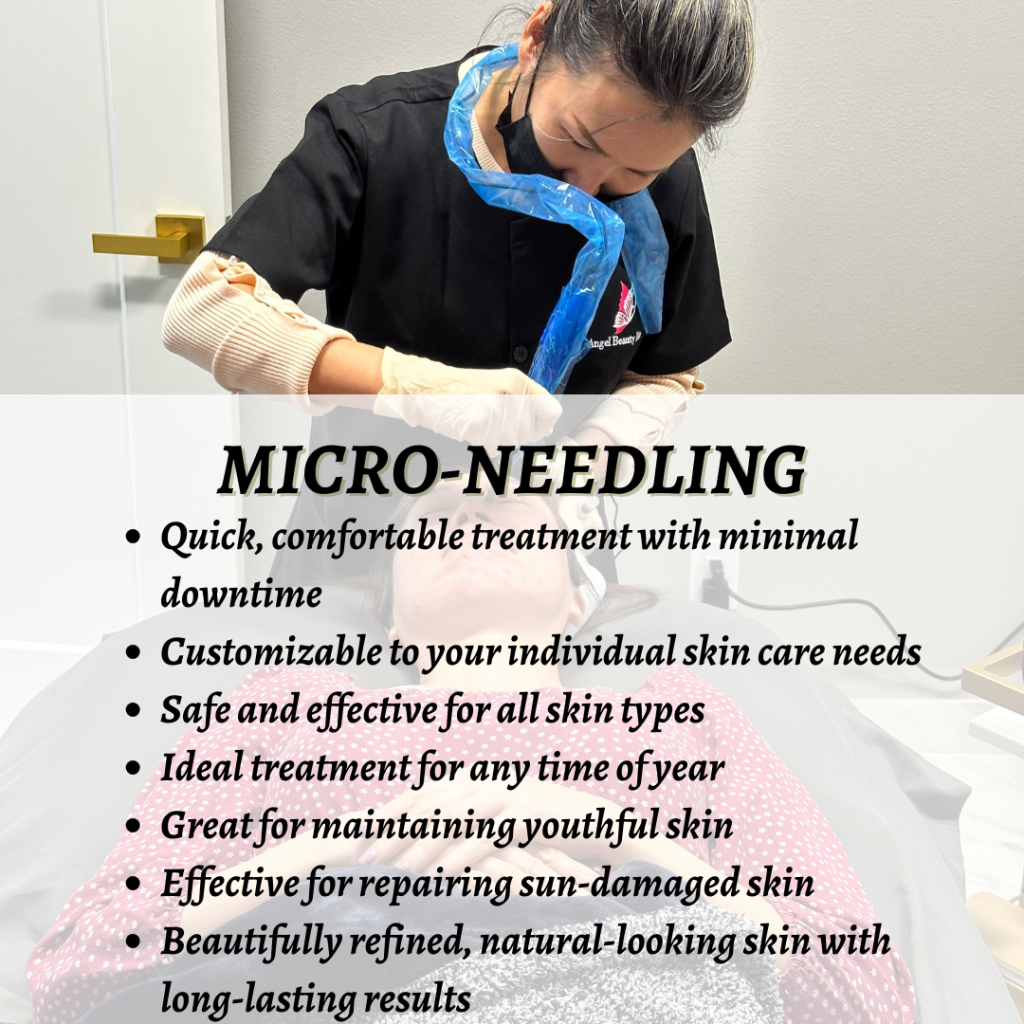 Close-up of micro-needling procedure demonstrating its benefits.